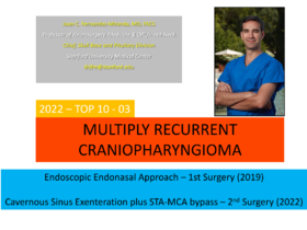 TOP3.多次复发颅咽管瘤