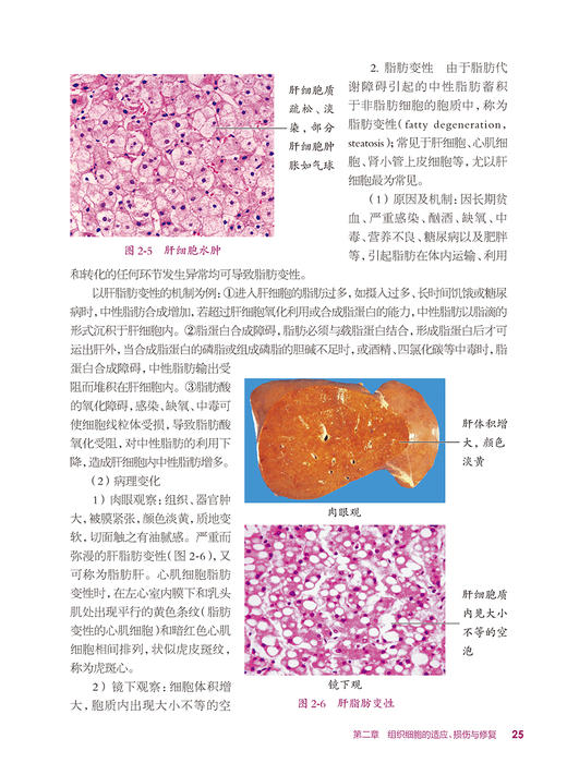 病理学基础 第4版 十四五规划教材 全国中等卫生职业教育教材供护理专业用 黄晓红 周士珍主编 人民卫生出版社9787117340618 商品图3