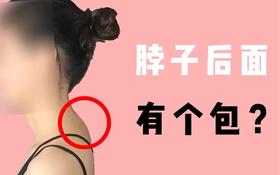  大椎凸起，意味着心脑血管寿命开始倒计时！刮痧+艾灸轻松除掉，尽早化解掉！ 