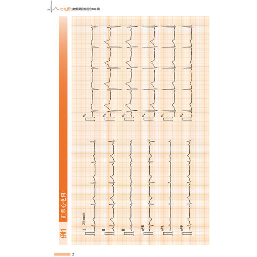 《心电图住院医师应知应会100例》 商品图2