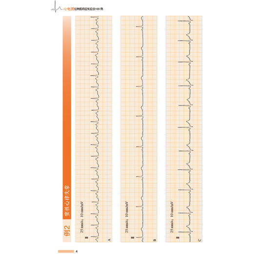 《心电图住院医师应知应会100例》 商品图4
