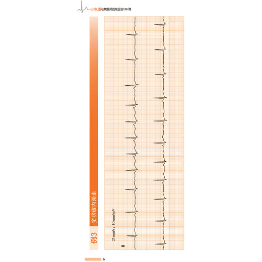 《心电图住院医师应知应会100例》 商品图6