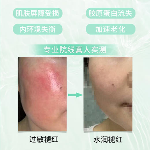 MBK美碧可冰肌修复面膜涂抹式补水保湿急救修护面膜送6个同款冰膜小样3ml 商品图3