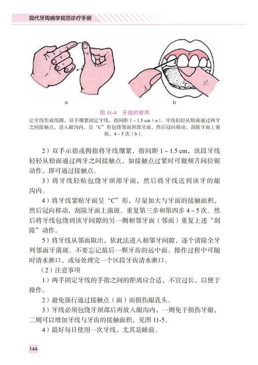 现代牙周病学规范诊疗手册 北大医学口腔临床规范诊疗丛书 栾庆先主编 牙周病基础治疗药物治疗 北京大学医学出版社 9787565925726 商品图4