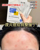 敷尔佳清痘净肤面膜（5片） 商品缩略图0