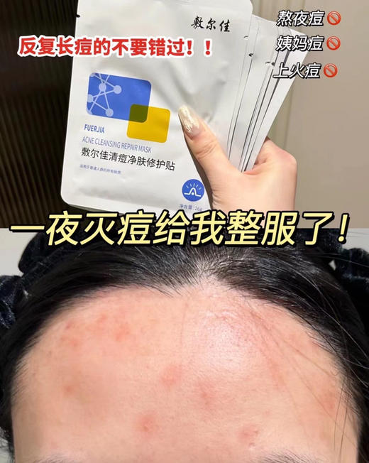 敷尔佳清痘净肤面膜（5片） 商品图0