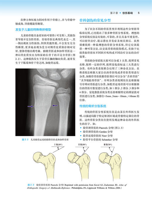 Hoppenfeld骨折治疗与康复 第2版 蔡斌 戴闽 张新涛主译 骨折固定愈合治疗原则技术感染处理康复训练 人民卫生出版社9787117338004 商品图3