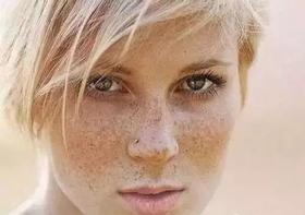 长斑不仅是面子问题，还是健康危机！