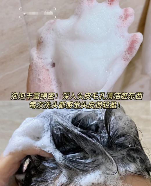 【现货】【去屑克星，雪花头终JIE者】【全网销量30万+单品薇姿绿标洗发水】【去屑一瓶见xiao】【百位皮肤/毛发/美容领域的zhuan家实证 可以改善头油腻扁塌】 商品图8