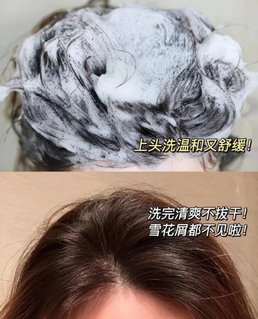 【现货】【去屑克星，雪花头终JIE者】【全网销量30万+单品薇姿绿标洗发水】【去屑一瓶见xiao】【百位皮肤/毛发/美容领域的zhuan家实证 可以改善头油腻扁塌】 商品图9