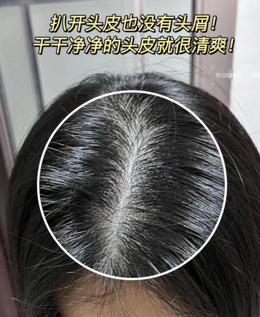 【现货】【去屑克星，雪花头终JIE者】【全网销量30万+单品薇姿绿标洗发水】【去屑一瓶见xiao】【百位皮肤/毛发/美容领域的zhuan家实证 可以改善头油腻扁塌】 商品图13