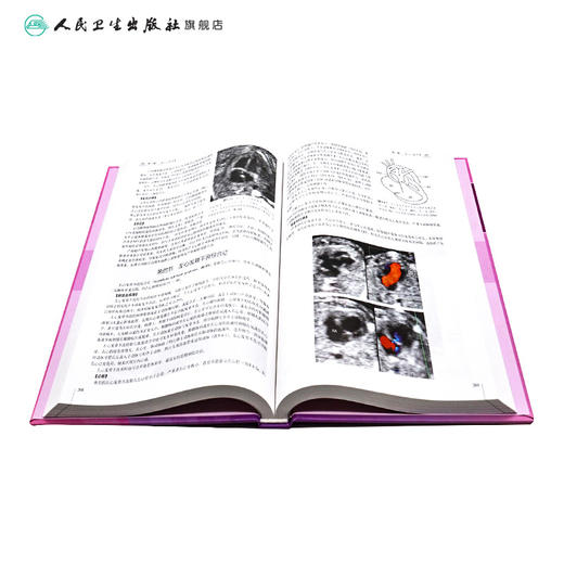 产前超声诊断学 第2版 临床医生必读 9787117152228 妇产科 人民卫生出版社 商品图4