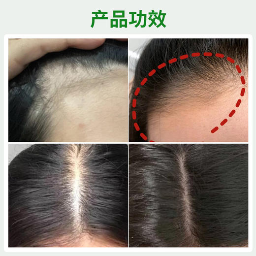 【清仓好价】柳屋生发喷雾190ml（限23.8） 商品图1