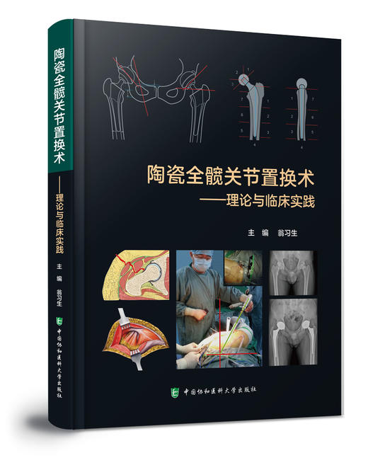 陶瓷全髋关节置换术——理论与临床实践   主编：翁习生  协和出版 商品图0