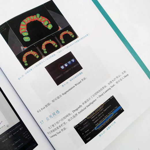 AI医学图像处理（基于Python语言的Dragonfly）人工智能医学图像医学影像数据分析python编程书计算机书籍 商品图4