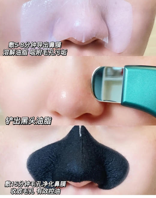 //【柏翠丝黑头铲套装】3步搞定草莓鼻，成分安全温和！致敏率几乎为零 商品图4