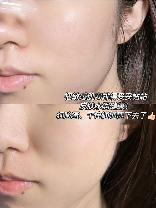 可复美胶原棒次抛精华30支/100支/盒  胶原蛋白玻尿酸屏障肌肤精华敏感肌修复保湿 商品图13