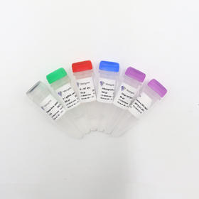 HiScript II 1st Strand cDNA Synthesis Kit (+gDNA wiper)