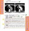 CT读片指南（第三版） 商品缩略图7