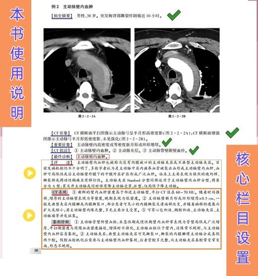 CT读片指南（第三版） 商品图7