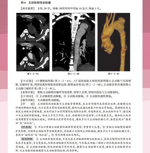 CT读片指南（第三版） 商品图6