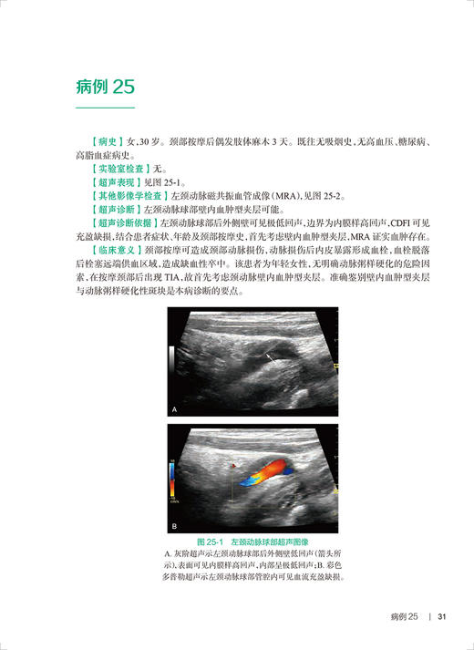 外周血管疾病超声图解100例 张波勇强 住院医师超声医学PBL教学培训系列教程 提高超声诊断准确性用书人民卫生出版社9787117337601 商品图3