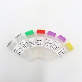 HiScript II Q Select RT SuperMix for qPCR(+gDNA wiper)