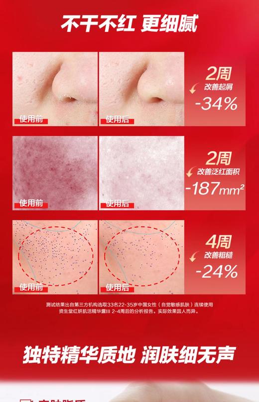 【资生堂红腰子】日本资生堂红妍肌活精华露100ml傲娇精华修复 商品图3