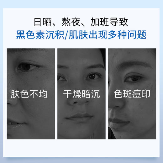 【拍一发二送正装】【雪元玑秘】青春定格美白四件套套装 商品图5