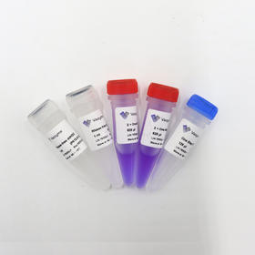 HiScript II One Step RT-PCR Kit (Dye Plus)