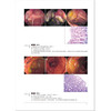 胃与肠 基因免疫异常引起的消化道病变 最新的话题 日本胃与肠编委会编 消化道形态学诊断内科 辽宁科学技术出版社9787559126405 商品缩略图4