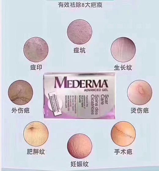 美版Mederma美德玛日用祛疤膏20ml。美国采购，无中文标签，介意慎拍!  A 商品图3