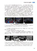 甲状腺与甲状旁腺疾病热消融治疗实战教程 于明安 王淑荣 疾病影像学病理学诊断消融技巧手法指导教材人民卫生出版社9787117341875 商品缩略图4