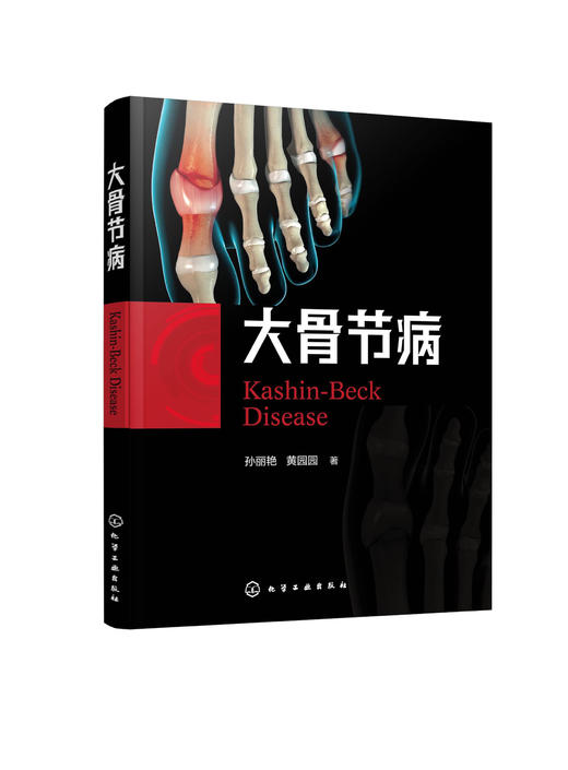 大骨节病（孙丽艳） 商品图0