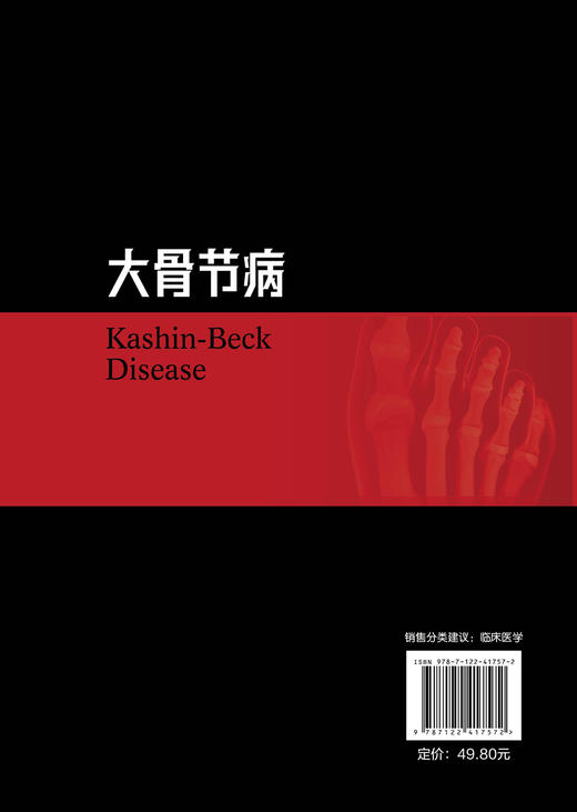 大骨节病（孙丽艳） 商品图1