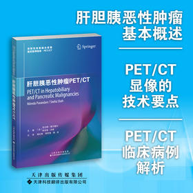 肝胆胰恶性tumourPET/CT PET/CT 肝胆胰恶性肿瘤 伪影 TNM分期