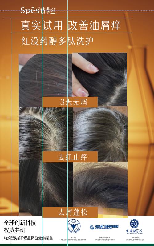 【品牌直发】【头油长痘/头屑头痒】Spēs 红没药醇去屑止痒洗发水/护发素500ml  商品图7
