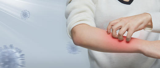 瞒不住了！过敏星人的隐藏身份竟然是... 商品图0