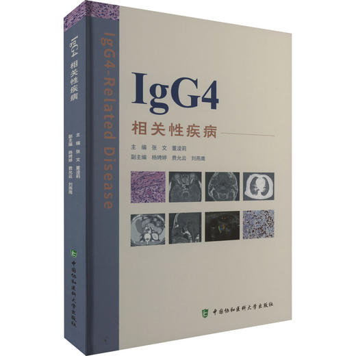 IgG4相关性疾病 商品图0