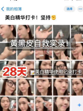 变白真不是难事！亲测28天打开成功上岸！