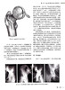 现代髋部骨折治疗理念与技术 周方主编 基础研究骨折分类临床治疗 围手术期处理快速康复创伤骨科北京大学医学出版社9787565927423 商品缩略图4