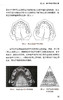 现代口腔正畸学规范诊疗手册 李巍然主编 附视频讲解 北大医学口腔临床规范诊疗丛书 医生案头书 北京大学医学出版社9787565927126 商品缩略图3