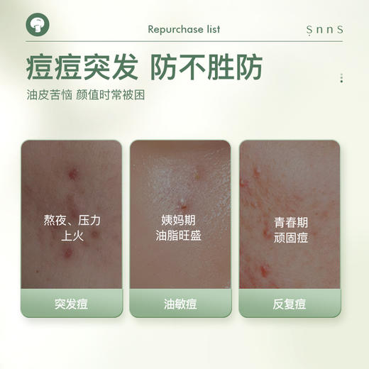 SNNS祛痘点涂精华液   急救祛痘  18g 商品图2