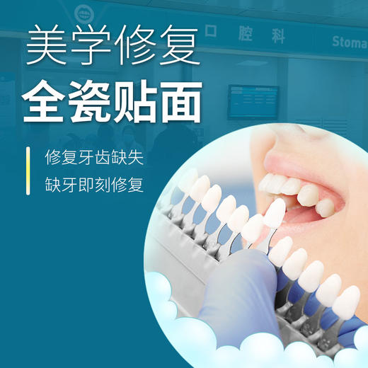 美学修复全瓷贴面 商品图0