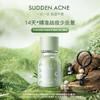SNNS祛痘点涂精华液   急救祛痘  18g 商品缩略图1