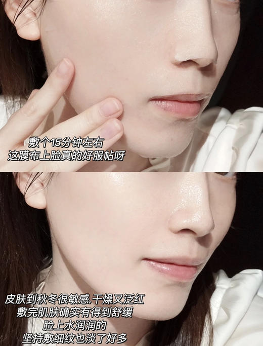 全新第四代！欧莱雅玻色因安瓶面膜补水保湿修复淡纹 商品图10