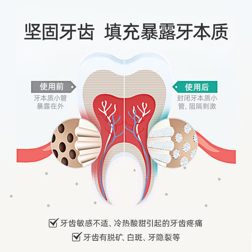 ⁴89元3支起【8018生物活性玻璃配方牙膏】成人&儿童款 不含氟防蛀固齿 牙龈养护牙膏 你的口腔我来呵护 YC04-CRMM-8018【TOP】 商品图7