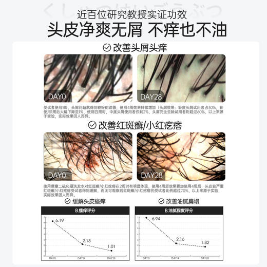 【🔥低至￥29.75/件|119选4件|9月超级会员日】二硫化硒去屑洗发水控油蓬松除螨止痒毛囊溢脂性皮炎官方正品 商品图2