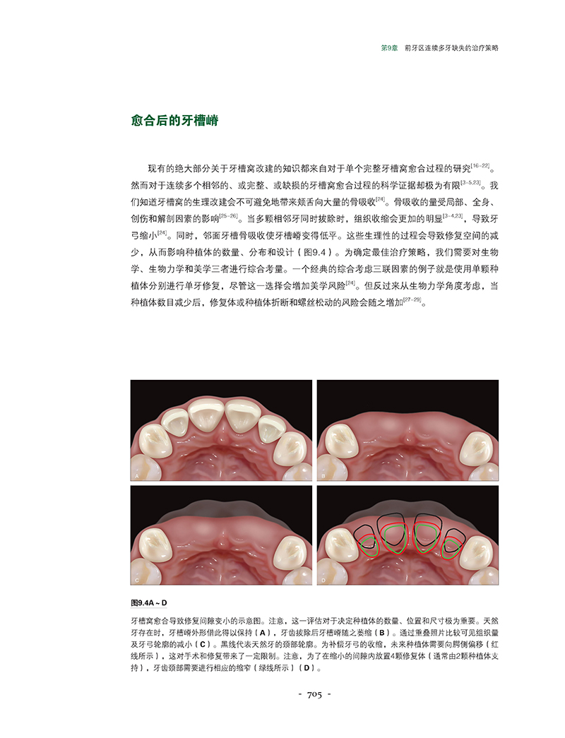 美学区牙周种植手术精要-精彩页5.jpg