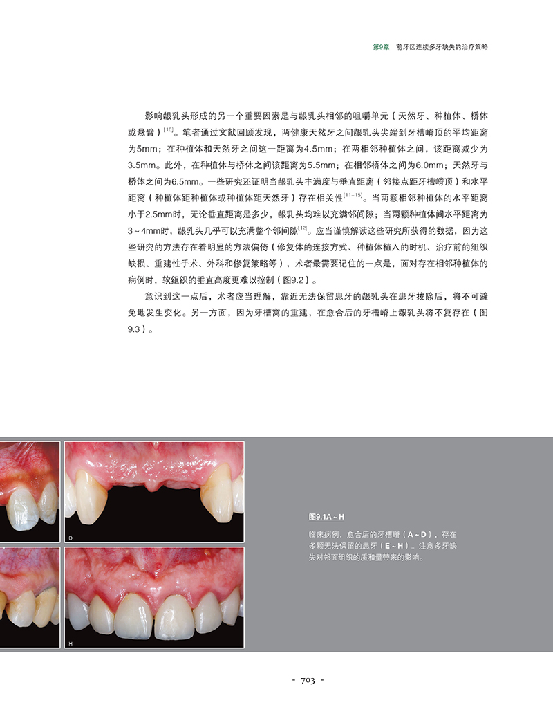 美学区牙周种植手术精要-精彩页3.jpg